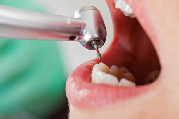 Best Emergency Tooth Extraction  in Bellevue, ID